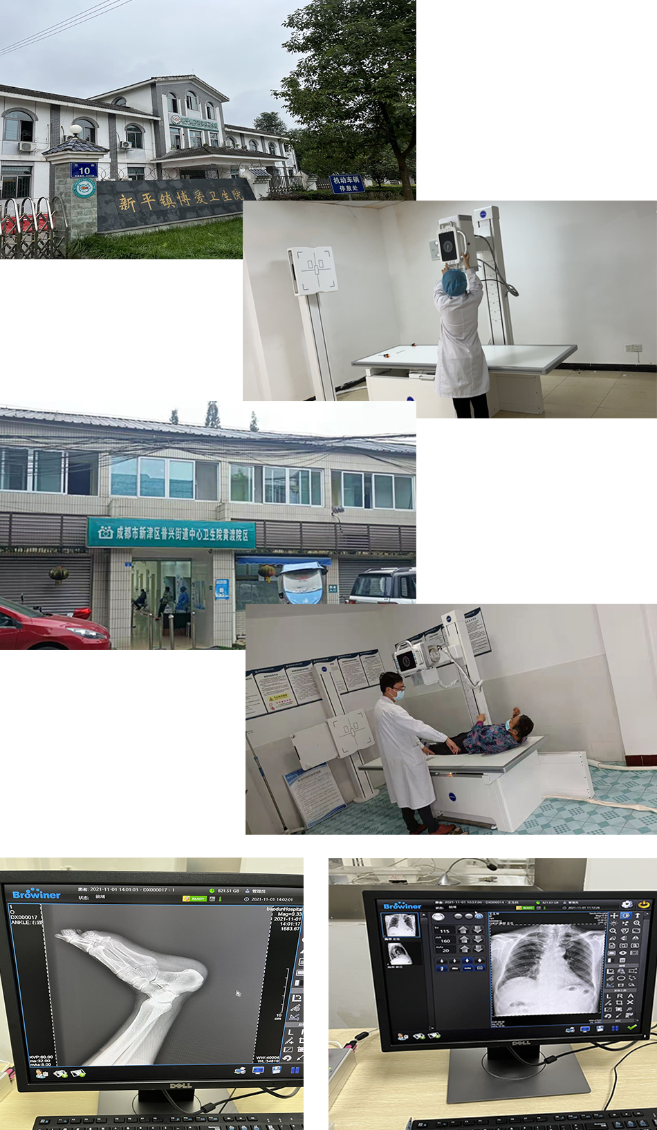 “雨润工程”系列报道——四川省基层医疗 “雨润工程”系列报道——四川省基层医疗