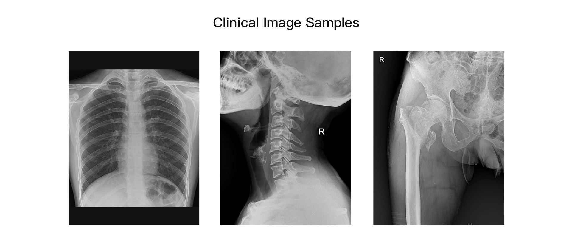 MobileGeniusMobileGenius,Mobile X-ray,Mobile Digital X-ray