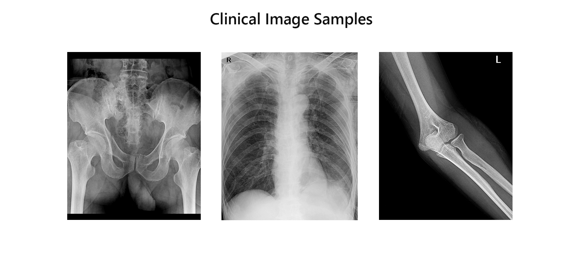 Mobile X-ray,Mobile radiography system,Mobile Digital X-ray