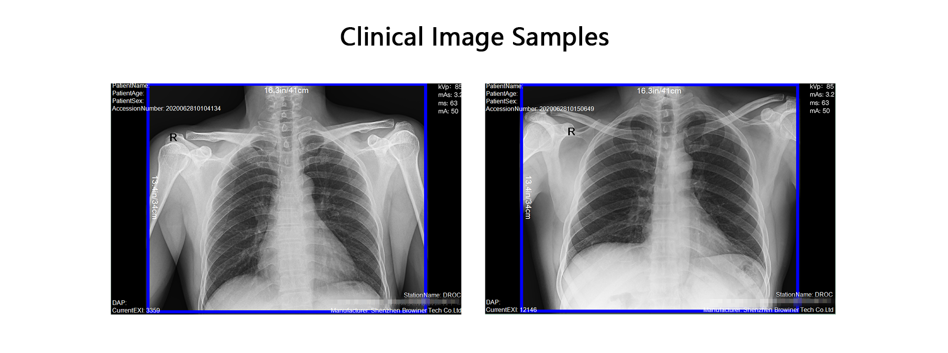 Portable X-ray,Portable Digital X-ray