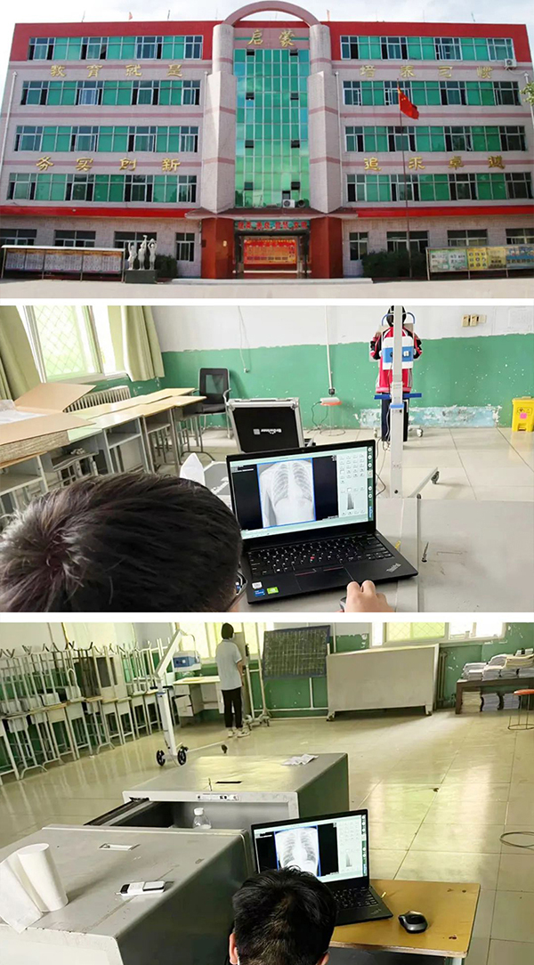 Browiner Portable DR Completed Chest X-rays for 2,000 Students in 2 days