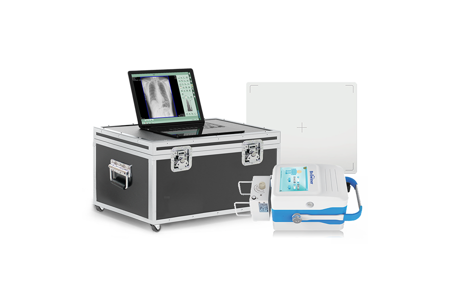 Portable X-ray System