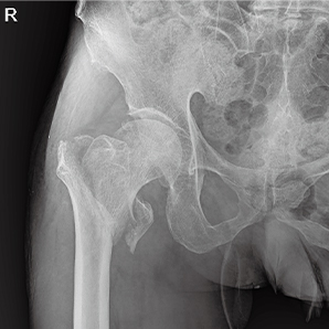 Advanced Digital Mobile X-ray System