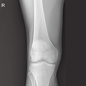 Advanced Digital Mobile X-ray System