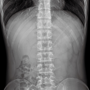 Advanced Digital Mobile X-ray System
