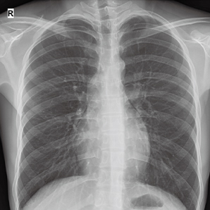 Advanced Digital Mobile X-ray System