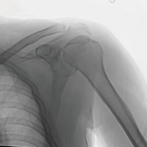 Système de bras C chirurgical avec FPD