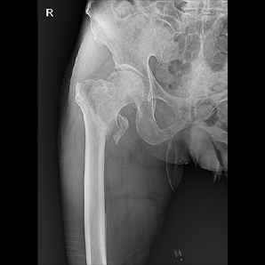 Motorized Mobile X-ray System
