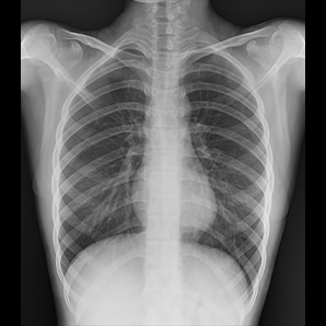 Motorized Mobile X-ray System