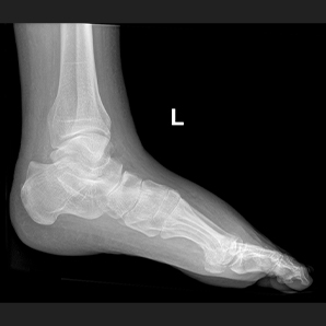 Motorized Mobile X-ray System