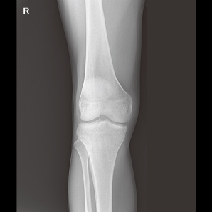 Motorized Mobile X-ray System