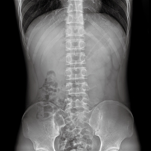 High Frequency Mobile X-ray System