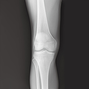 High Frequency Mobile X-ray System