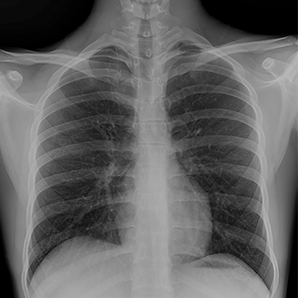 Cost-effective Mobile X-ray System