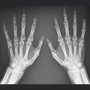 Portable X-ray lmaging Device