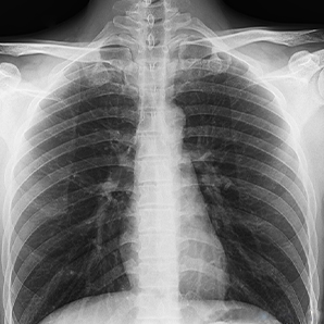 Portable X-ray System