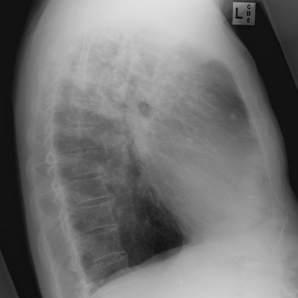 Intelligent Ceiling Suspension Radiographic System