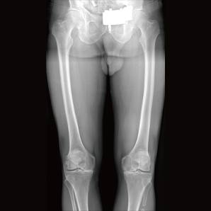 Motorized Floor-mounted Radiography System
