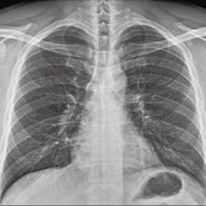 Highly Customizable Floor-mounted Radiography System