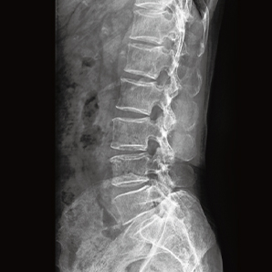 Highly Customizable Floor-mounted Radiography System