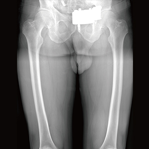 Highly Customizable Floor-mounted Radiography System