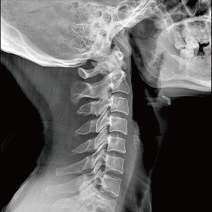 U-arm Radiography System