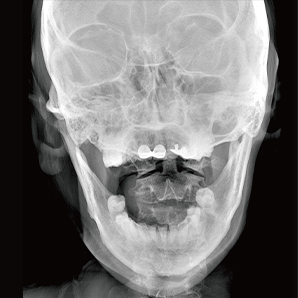 U-arm Radiography System