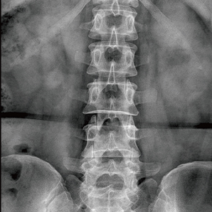 U-arm Radiography System