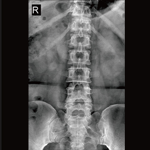 U-arm Radiography System