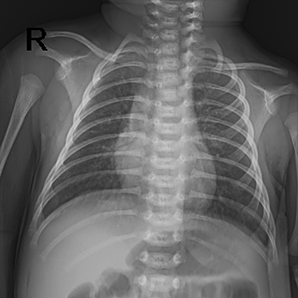 Medical X-ray System for Neonatology