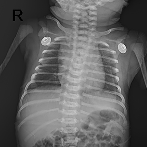 Medical X-ray System for Neonatology