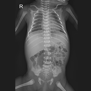 Medical X-ray System for Neonatology