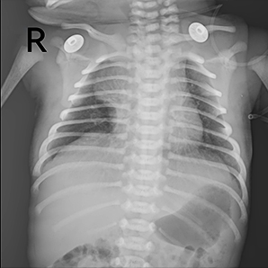 Medical X-ray System for Neonatology