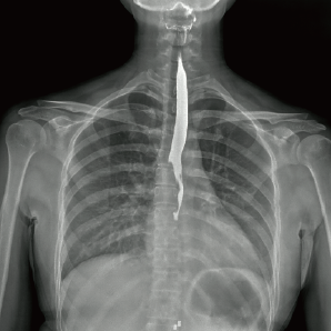 Multi-functional Radiography and Fluoroscopy System
