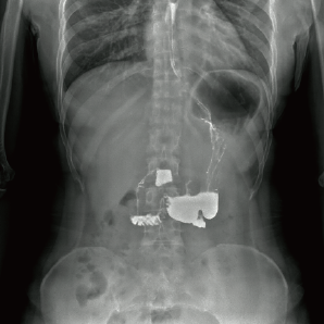 Multi-functional Radiography and Fluoroscopy System