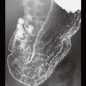 Multi-functional Radiography and Fluoroscopy System