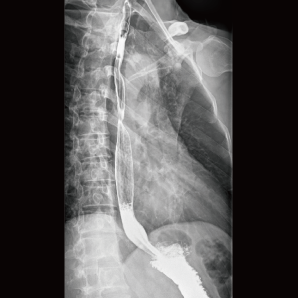 Multi-functional Radiography and Fluoroscopy System