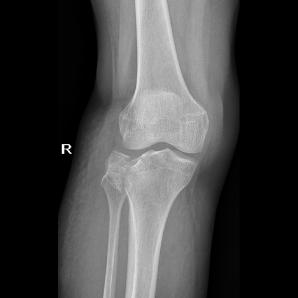 Portable Orthopedic X-Ray Imaging