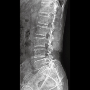 PerfoX 3000 Plus  X-ray clinical imaging