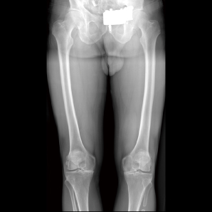 erfoX 3000 Plus  X-ray clinical imaging