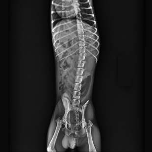 Beatle-01P X-ray clinical imaging 3