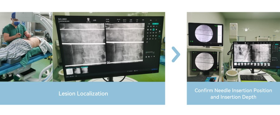 Clinical Applications of Mobile C-Arm Imaging Systems in Modern Surgery: From Orthopedics to Interventional Procedures