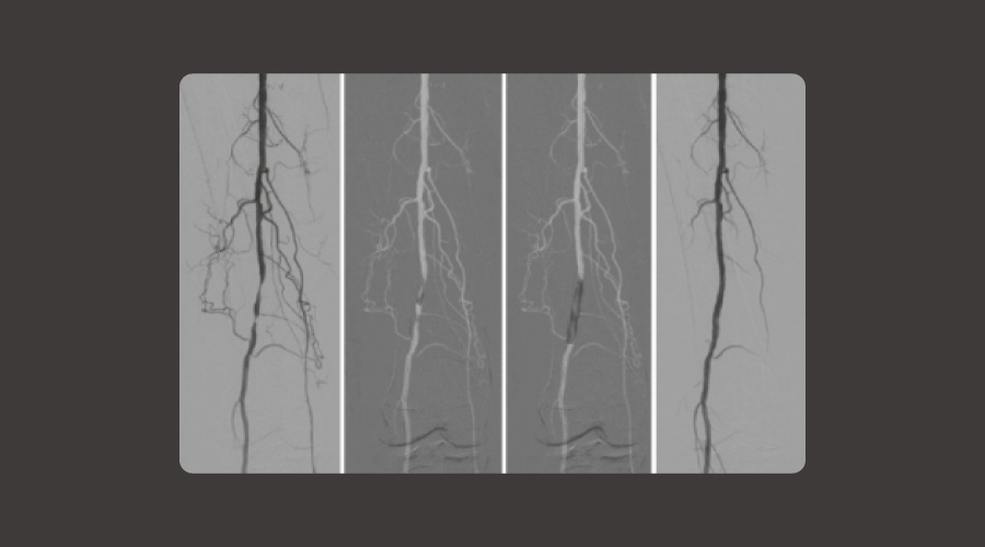 Clinical Applications of Mobile C-Arm Imaging Systems in Modern Surgery: From Orthopedics to Interventional Procedures