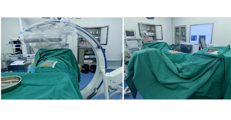 Clinical Application of C-Arm Imaging in Percutaneous Vertebroplasty (PVP)