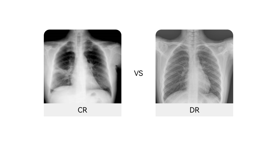 AR、CR VS DR: WHICH ONE SHOULD BE YOUR BEST CHOICE?cid=44