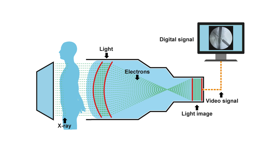 Flat Panel Detector VS Image Intensifier: Which one should be your best choice?cid=46