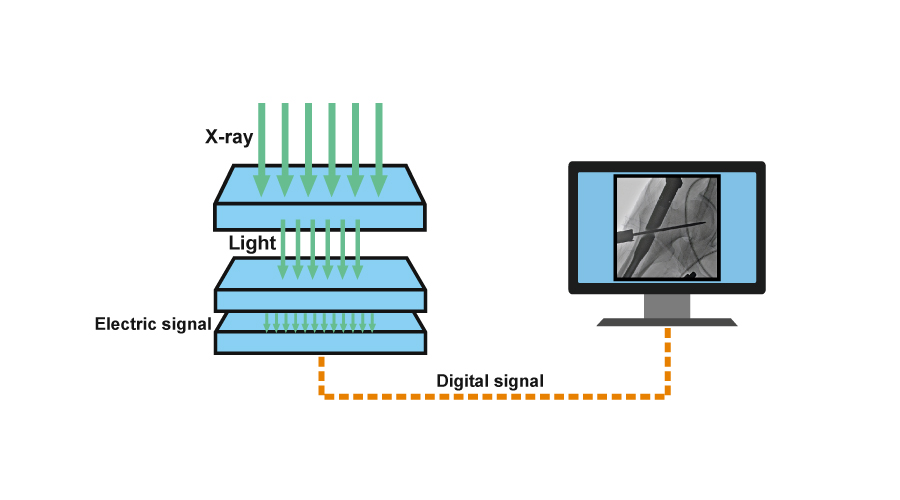 Flat Panel Detector VS Image Intensifier: Which one should be your best choice?cid=46
