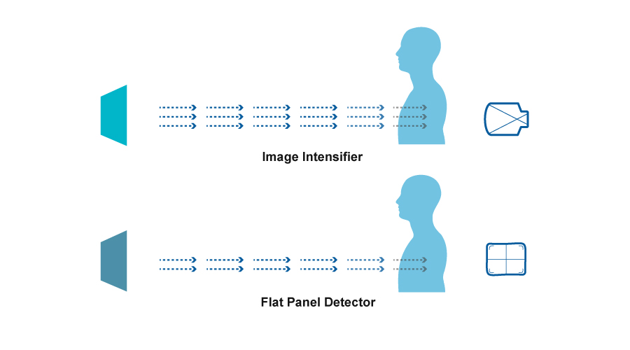 Flat Panel Detector VS Image Intensifier: Which one should be your best choice?cid=46