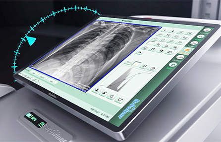MobileApex-1
